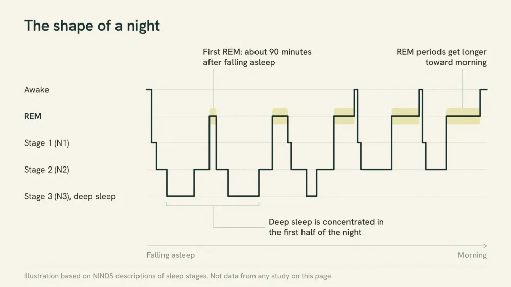 Illustrated chart of a typical night of sleep moving between awake, REM and non-REM stages, with deep sleep clustered early in the night and REM periods growing longer toward morning.