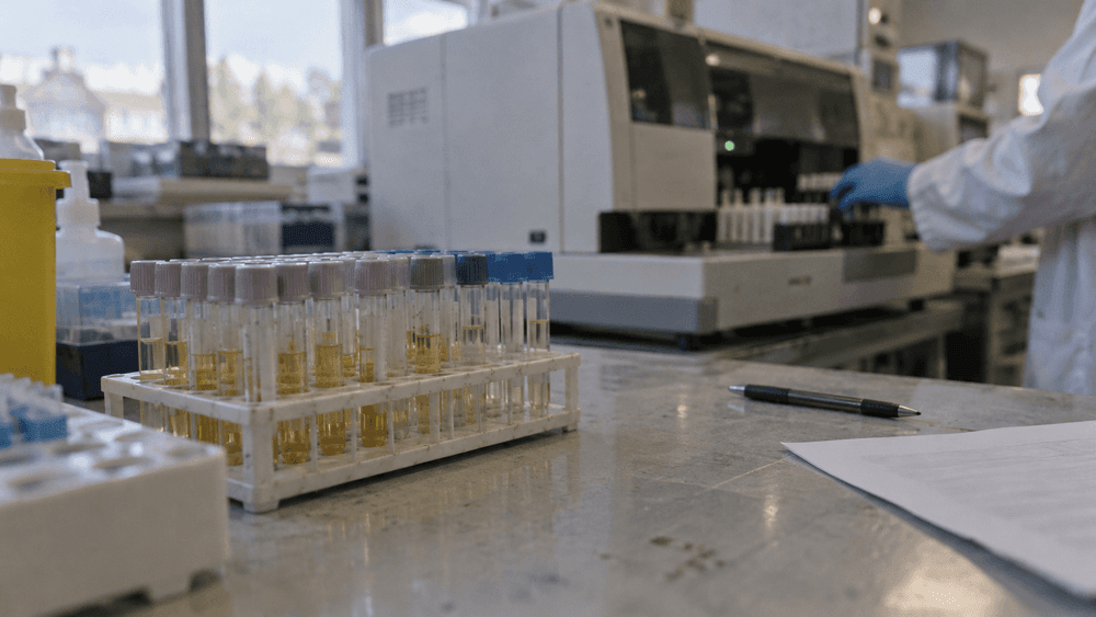 Rows of capped urine sample tubes in a rack on a clinical laboratory bench, with a blurred analyzer and a technician's gloved hand in the background.